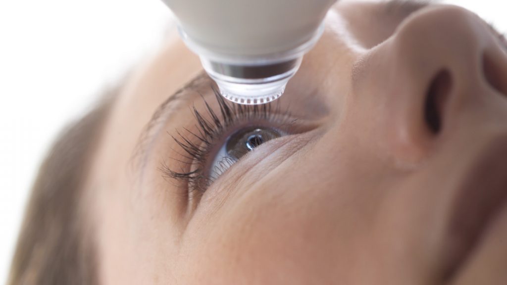 Chirurgie des yeux au laser