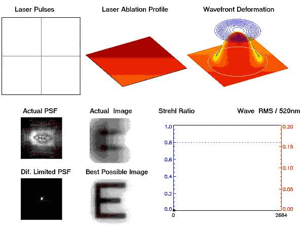 Laser ablation