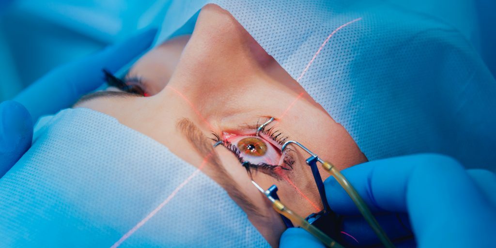 Refractieve chirurgie